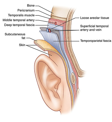 Illustration of the temporoparietal fascia